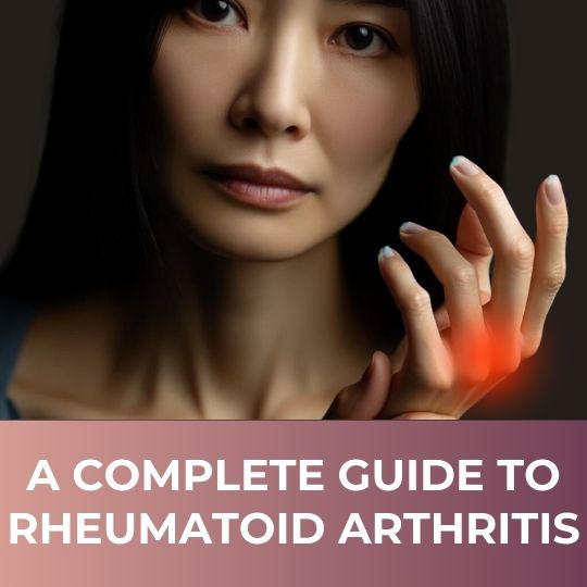 A Complete Guide on Rheumatoid Arthritis