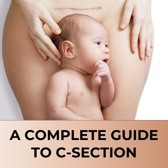 UNDERSTANDING C-SECTIONS: A DETAILED GUIDE FOR EXPECTANT MOTHERS