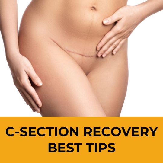Best Tips for C-Section Fast Recovery