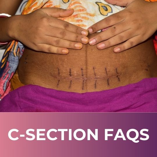 C-SECTION: EXPERT ANSWERS TO YOUR MOST COMMON CONCERNS