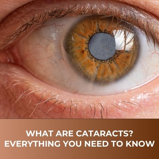 WHAT ARE CATARACTS? A COMPLETE GUIDE