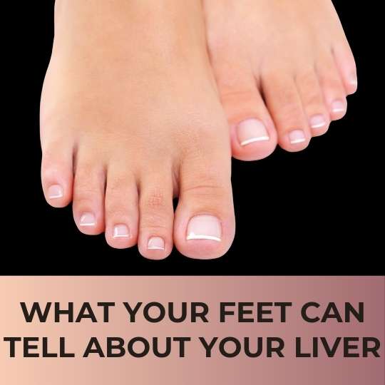 WHAT YOUR FEET CAN REVEAL ABOUT THE CONDITION OF YOUR LIVER!