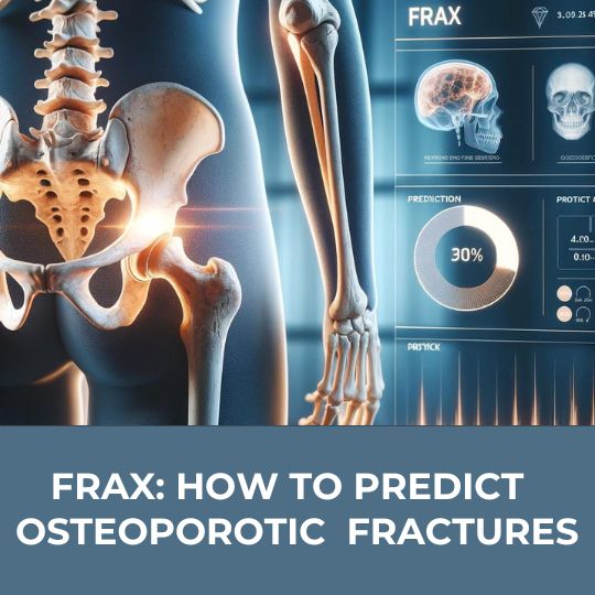 FRAX: How to Predict and Prevent Osteoporotic Hip Fractures