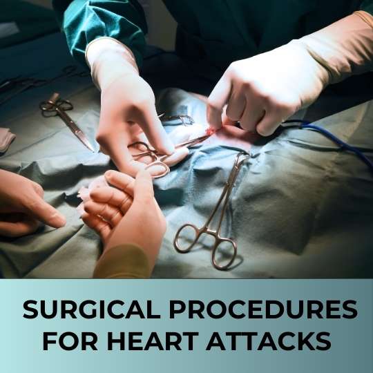 UNDERSTANDING SURGICAL PROCEDURES FOR HEART ATTACKS