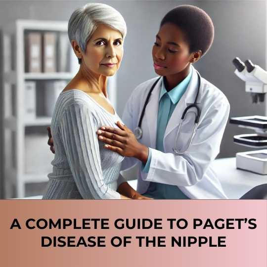 A Complete Guide To Paget’s Disease of the Nipple