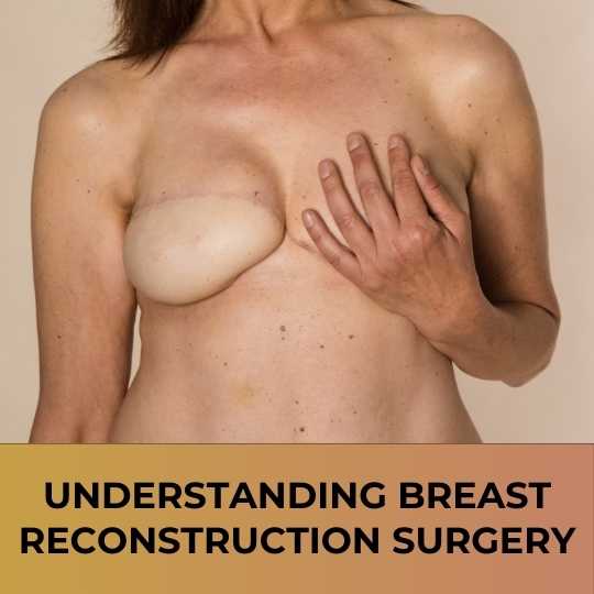 Understanding Breast Reconstruction Surgery