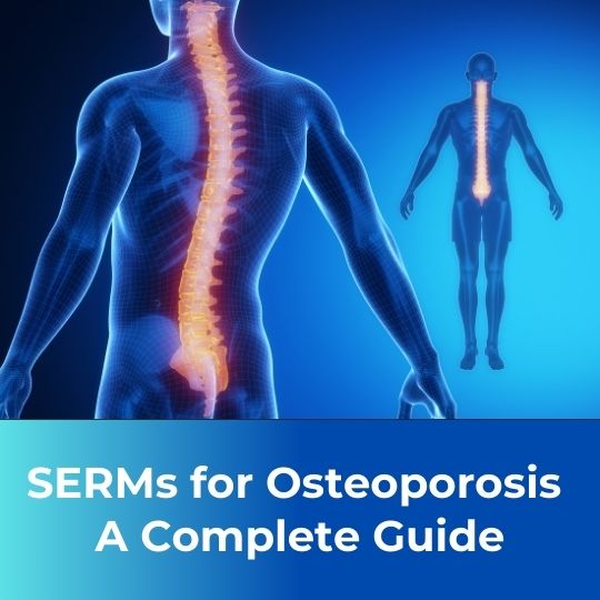 A Complete Guide to SERMs for Osteoporosis