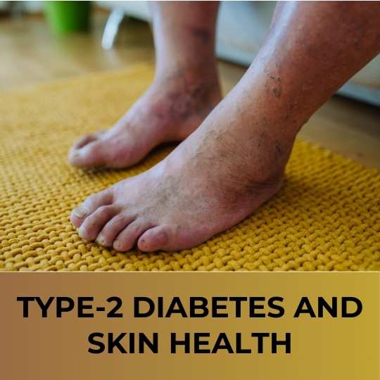 Type-2 Diabetes and Skin Health