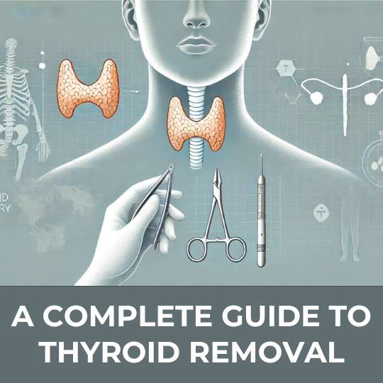 A Complete Guide to Thyroid Removal