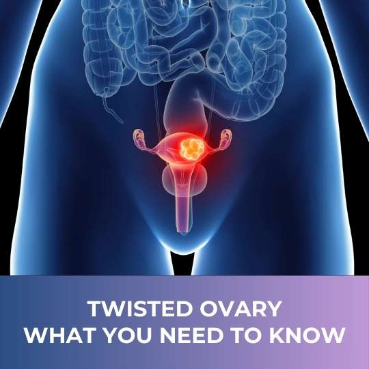 Ovarian Torsion (Twisted Ovary)