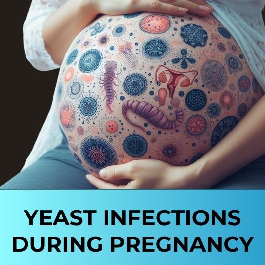 YEAST INFECTIONS DURING PREGNANCY